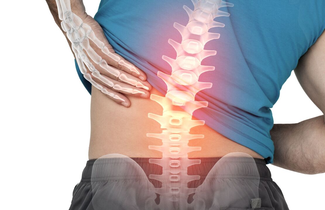 The danger of lumbar ostechondrosis