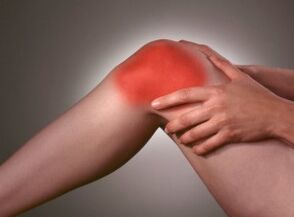 The symptom of arthrosis is severe pain in the knee area